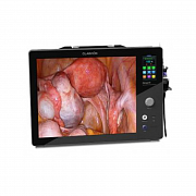 Chammed Qvion 19 (HD)
